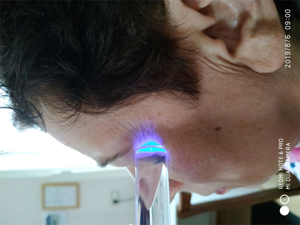 LED device for oral irradiation